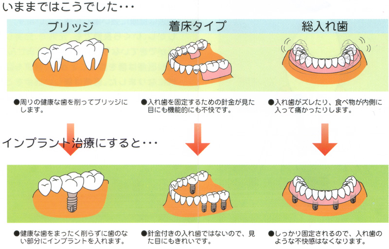 歯科 インプラント ホワイトニング ニシキ歯科